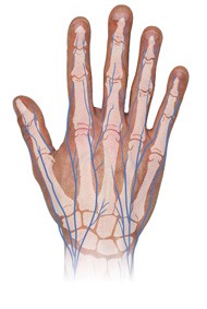 RPM-IDF-PATHOLOGIES-Main-Anatomie