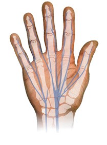 RPM-IDF-PATHOLOGIES-Main-Anatomie